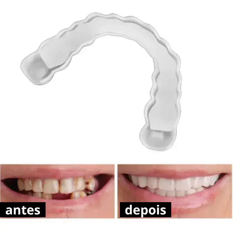[ 🔥 BRECK FRIDAY 🔥 ] Lente Smile Odontológicas Removíveis - Resina 3M™ Fil Tek™