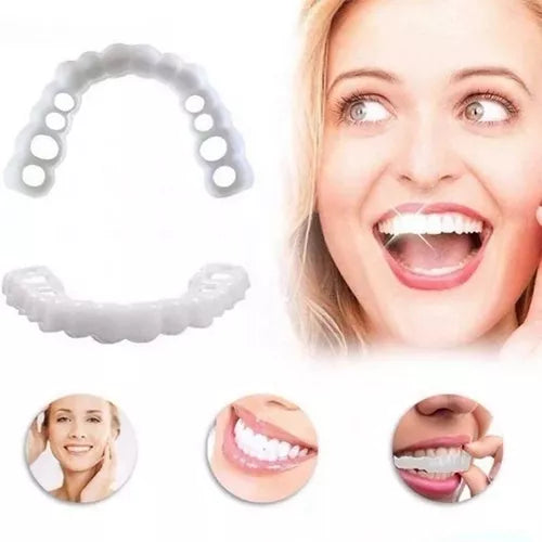 [ 🔥 BRECK FRIDAY 🔥 ] Lente Smile Odontológicas Removíveis - Resina 3M™ Fil Tek™